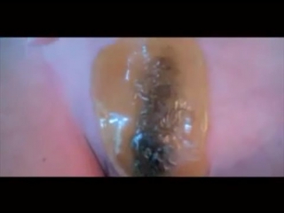 hair removal with wax, on the female genital organs - video not for the faint of heart